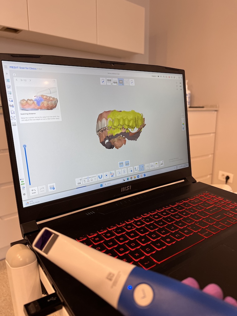 Scannerul intraoral Medit i600